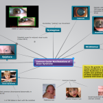 Image 3. A section of a concept map for ocular manifestation of Down Syndrome. View the full map here. Click to enlarge