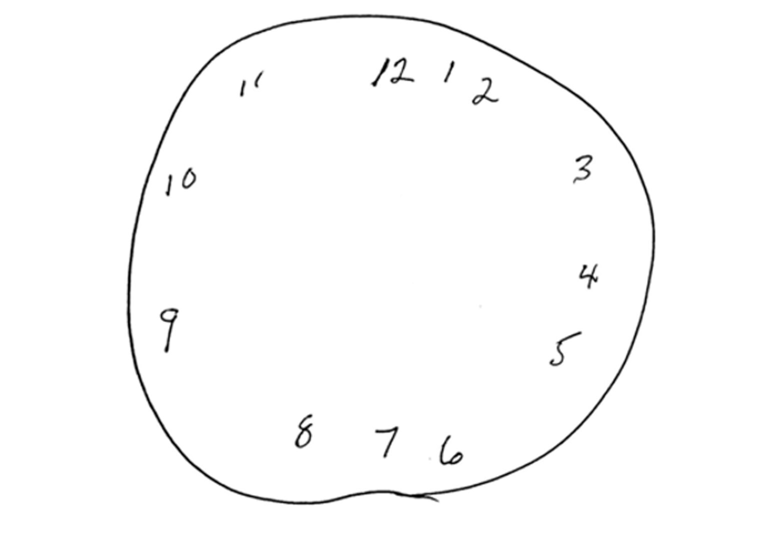 Navigating Visual Field Loss, Visual Neglect, and Ocular Dominance ...